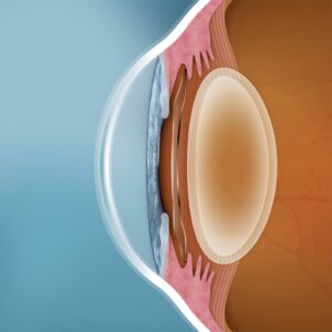 Implanteerbare collameer lens